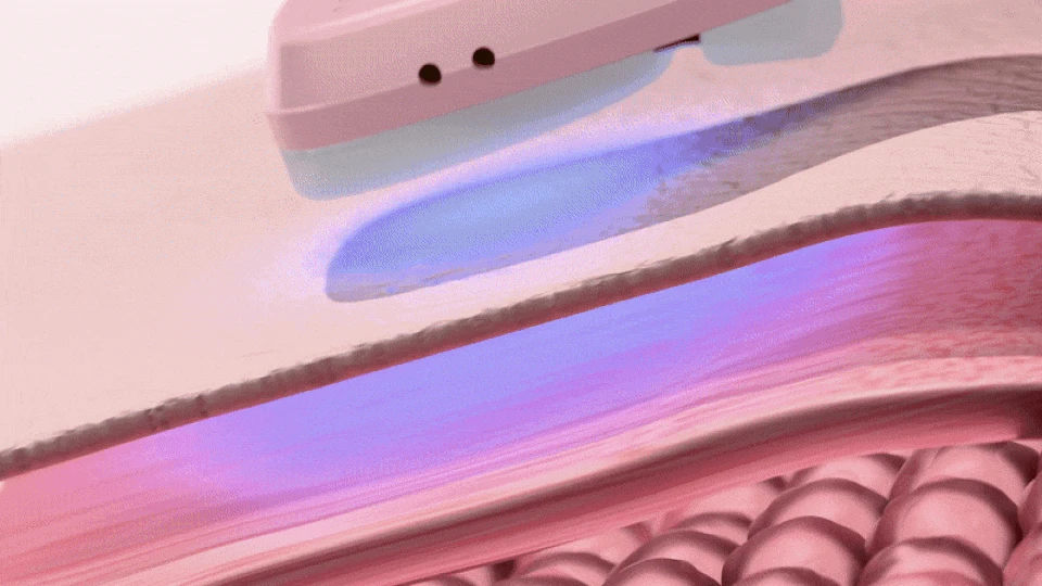 Thumbnail 49